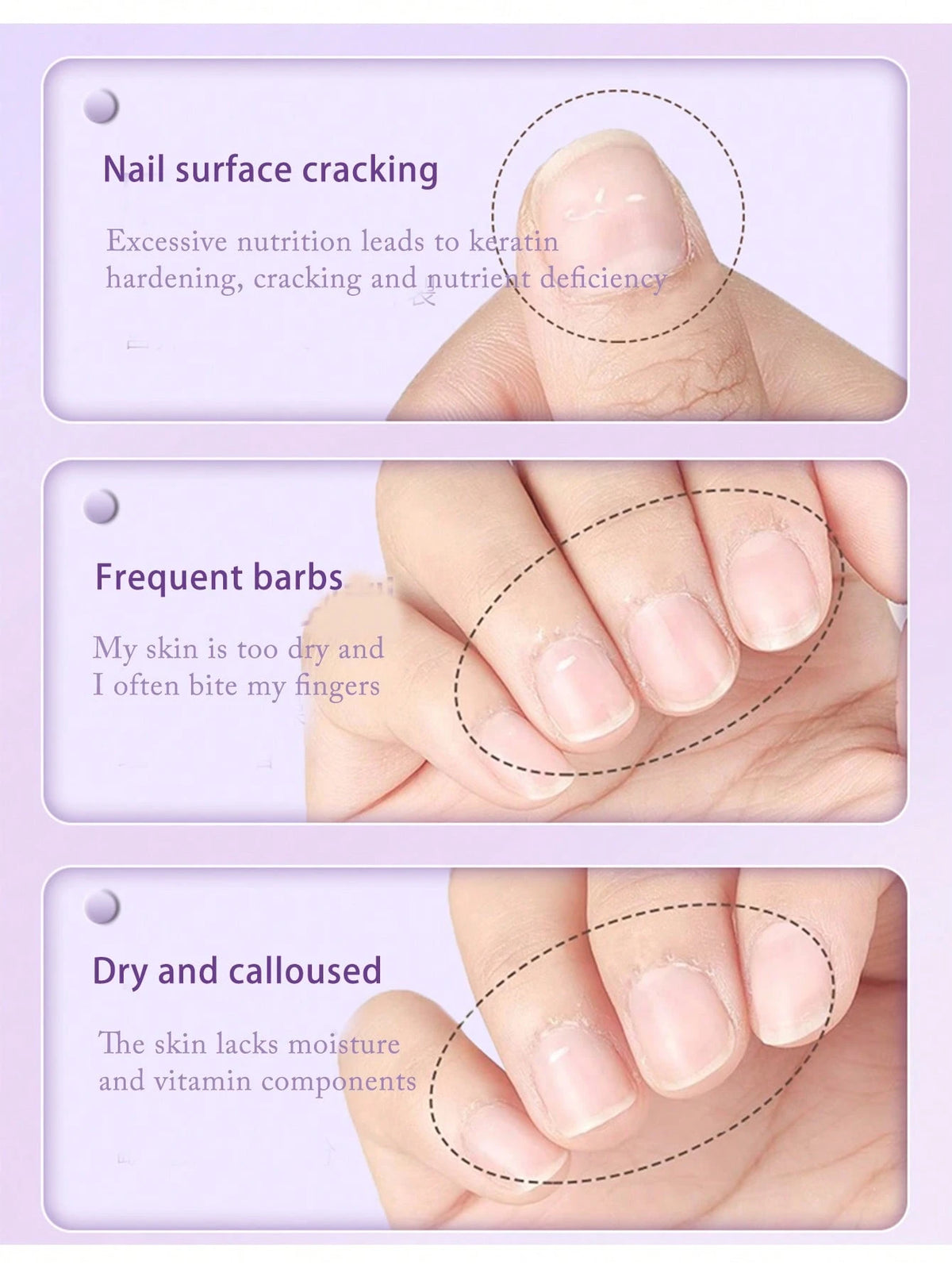3-In-1 Cuticle Oil Pen Cuticle Pusher Nail Oil Pen With Ceramic Tip, Cuticle Treatment For Hangnails, Dry & Damaged Nails, Nail Cuticle Remover Pen