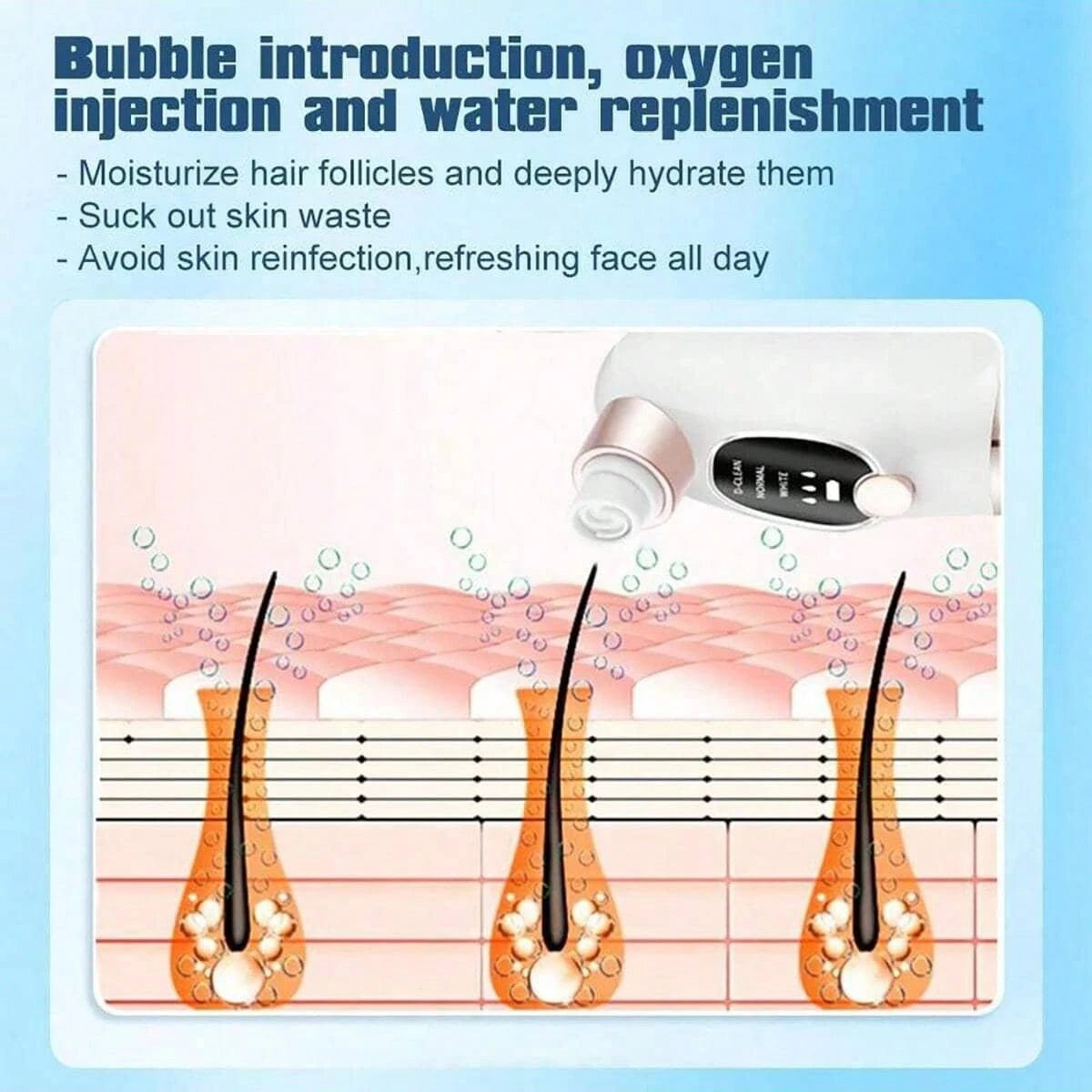 3-Speed Adjustable Blackhead Remover- Facial Blackhead Extractor Tool With 6 Suction Heads, Pore Vacuum Suction, USB Rechargeable, 400mAh Lithium Battery, Powerful Suction, Unisex