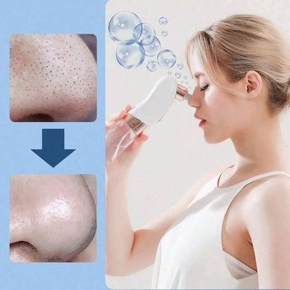 3-Speed Adjustable Blackhead Remover- Facial Blackhead Extractor Tool With 6 Suction Heads, Pore Vacuum Suction, USB Rechargeable, 400mAh Lithium Battery, Powerful Suction, Unisex