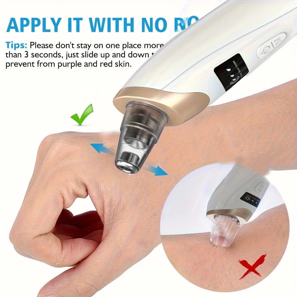 Electric Blackhead Remover, USB Charging, 5 Suction Tips And 3 Adjustable Gears, Electric Acne Removal Tool, Suitable For Both Women And Men, As A Gift For Women