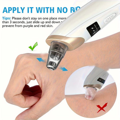 Electric Blackhead Remover, USB Charging, 5 Suction Tips And 3 Adjustable Gears, Electric Acne Removal Tool, Suitable For Both Women And Men, As A Gift For Women