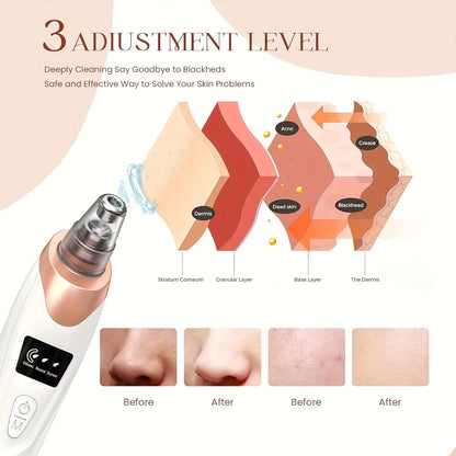 Electric Blackhead Remover, USB Charging, 5 Suction Tips And 3 Adjustable Gears, Electric Acne Removal Tool, Suitable For Both Women And Men, As A Gift For Women